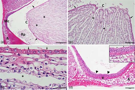 Renal adaptation in relation to insectivorous feeding habit in the greater mouse‐eared bat ...