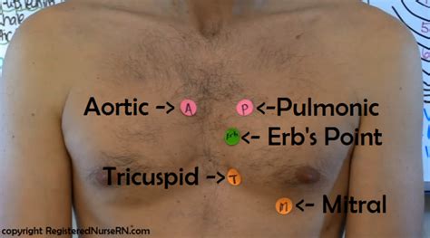 Auscultating the Heart | Nurse, Nursing school, Nursing school tips