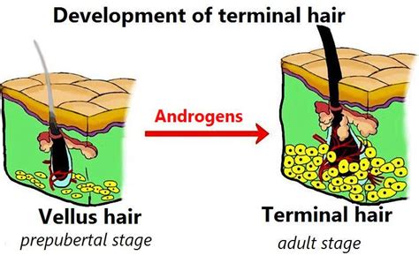 Difference Between Terminal Hair and Vellus Hair | Compare the ...