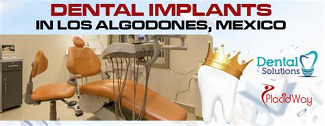 Dental Implants In Los Algodones Mexico - Dental News Network