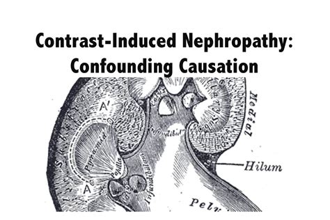 Contrast-Induced Nephropathy: Confounding Causation - emdocs