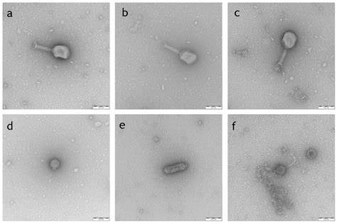 Electron micrographs of isolated phages belonging to different ...