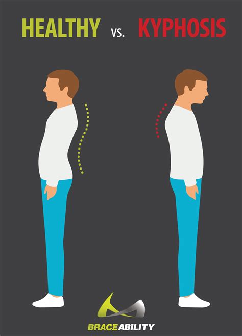 Kyphosis Back Braces Kyphosis Treatment Postural Kyph - vrogue.co