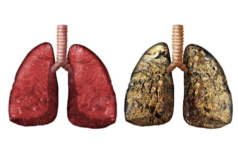 Smoking Lungs Before And After