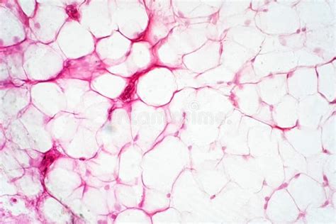 Human Fat Body Tissue Under Microscope View Stock Photo - Image of ...