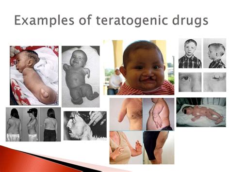 Teratogen Drugs