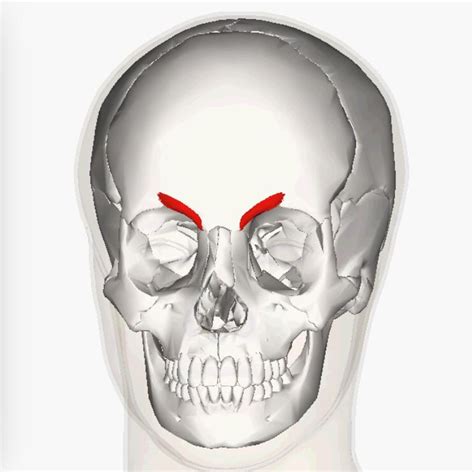 Corrugator supercilii: inferior frontal bone. Skin deep to medial ...