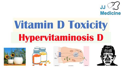 Vitamin D Toxicity (Hypervitaminosis D) | Causes, Pathophysiology, Symptoms, Diagnosis ...