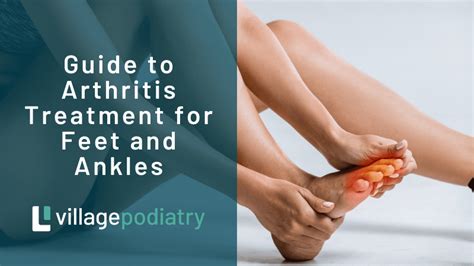 Guide to Arthritis Treatment for Feet and Ankles