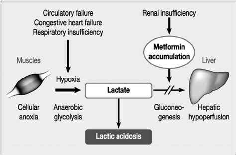 Metformin Lactic Acidosis Treatment