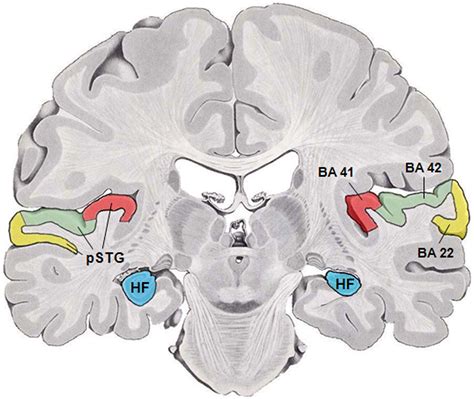 File:Human temporal lobe areas.png - Wikimedia Commons