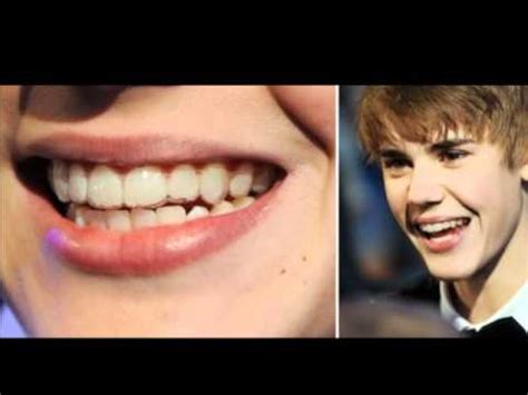 Justin Bieber with braces - YouTube