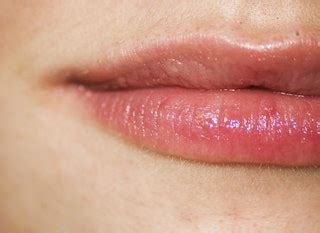 Can Cold Sores Leave Scars In Their Wake? Here's The Lowdown