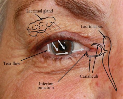 Socket anatomy - New Zealand Prosthetic Eye Service