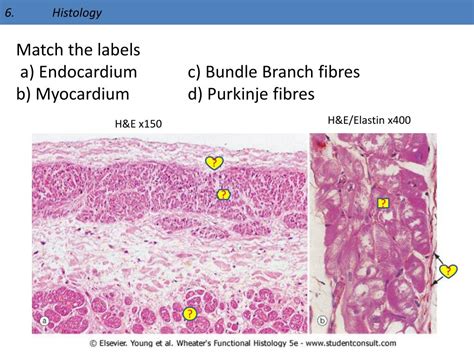 Cardiac Conduction System Histology - vrogue.co