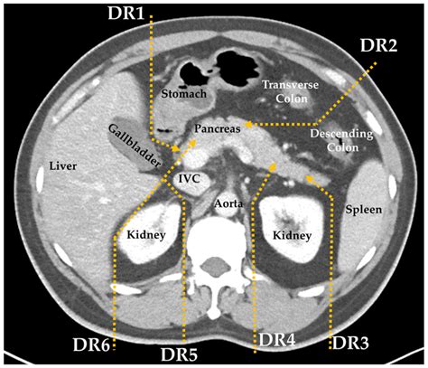 Normal Pancreas Cat Scan