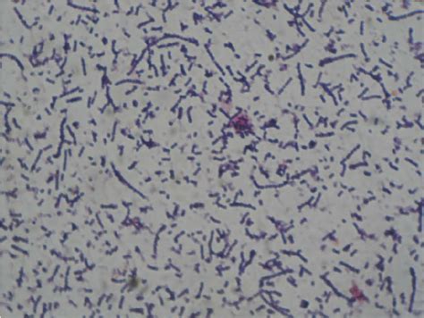 Mixed Gram-Positive Gram-Negative Bacillus, Gram Stain Microscope Slide Carolina Singapore ...