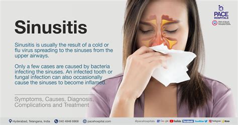 Sinusitis Causes Symptoms And Treatment Types Of Sinusitis Fitpage | The Best Porn Website