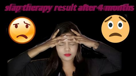 slap therapy || result after 4 months #slaptherapy #koreanskincare #koreanglassskin - YouTube