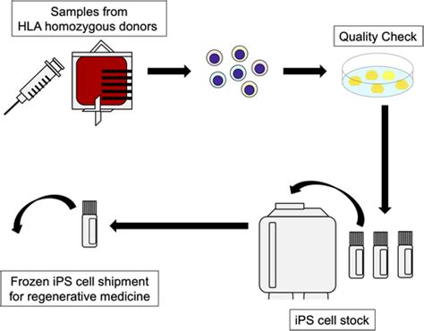 Current status and future directions of clinical applications using iPS ...