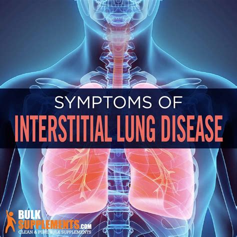 Interstitial Lung Disease: Symptoms, Causes & Treatment