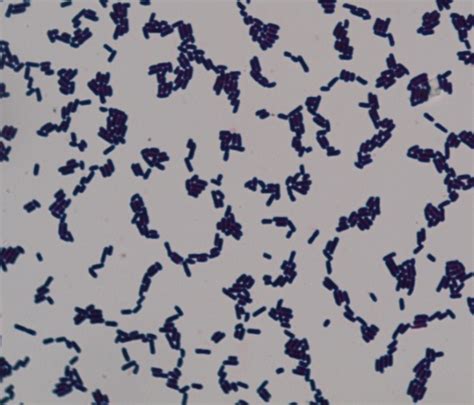 vincitore mescolare Al dettaglio clostridium perfringens gram stain ...