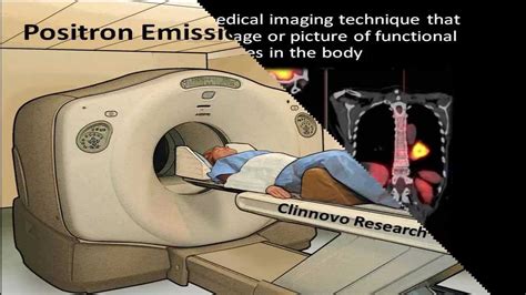 PET- Positron Emission Tomography - YouTube