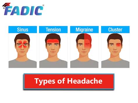 Types of Headaches