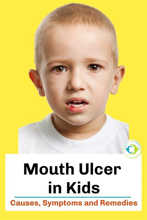 Mouth Ulcers in Kids | Causes, Symptoms, and Remedies