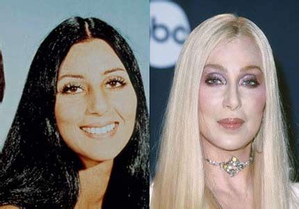 Cher Plastic Surgery Before and After Nose Job and Breast Implants - Star Plastic Surgery Before ...