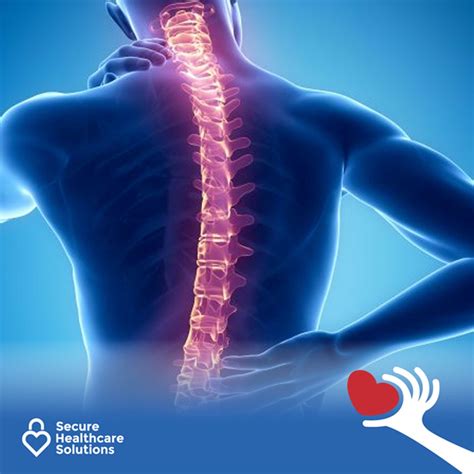 8 Things About Spinal Cord Injuries | Secure Healthcare Solutions