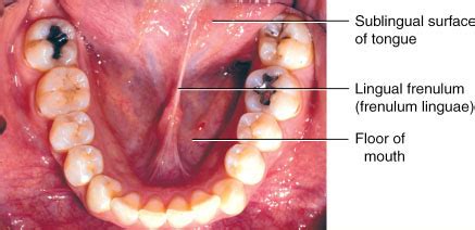 frenulum linguae