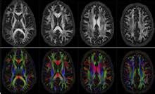 Brain Connectivity Mapping | University of Virginia School of Engineering and Applied Science