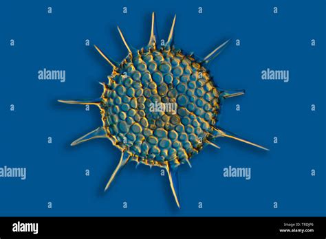 radiolarians (Radiolaria), fossile radiolarian ob Barbados island with Rheinberg lighting Stock ...