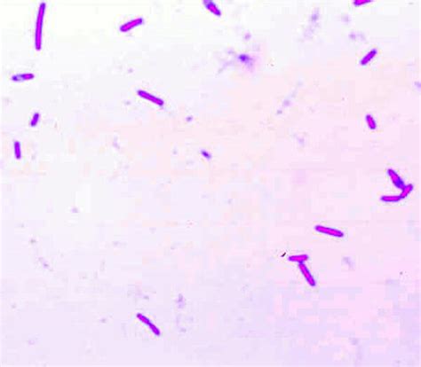 Clostridium botulinum: culture Gram stain in Cows (Bovis) | Vetlexicon