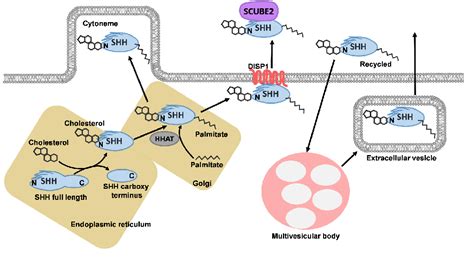 Figure 1 from The Role of Sonic Hedgehog in Human Holoprosencephaly and ...