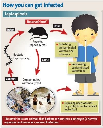 What you should know about Leptospirosis?