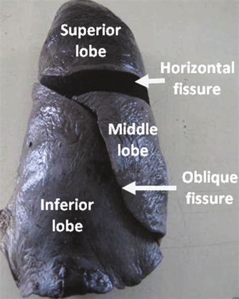 The left lung. Note the oblique and horizontal fissures dividing the ...