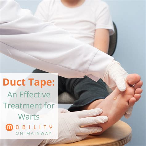 Planters Wart Removal Duct Tape | Bruin Blog