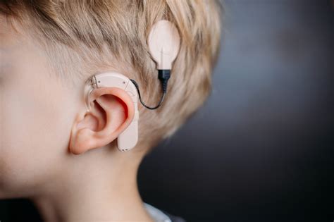 Cochlear Implants - Three Misunderstandings - Audiologist.co.uk