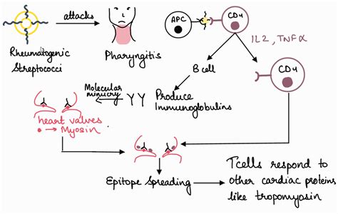 Acute Rheumatic Fever | Medical Junction