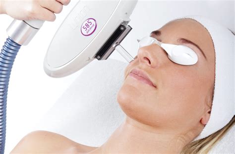 Treatment for Age Spots & Sun Damage · The Lynton Clinic, Cheshire