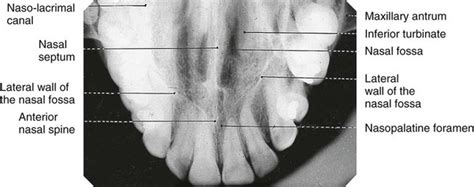 11: Occlusal radiography | Pocket Dentistry