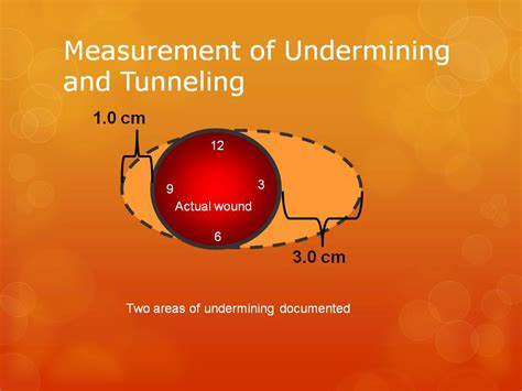 What Is Tunneling Wound