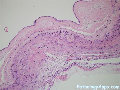 membrane placenta histology