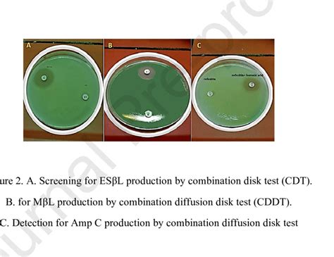 Kirby Bauer Disc Diffusion Method