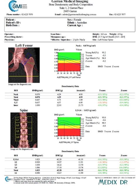 Dxa Scan Results