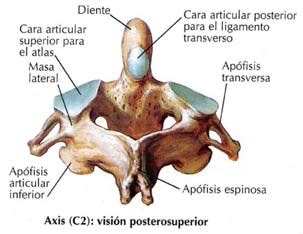 Segunda vértebra cervical o Axis. | Download Scientific Diagram