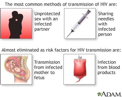 HIV/AIDS Information | Mount Sinai - New York