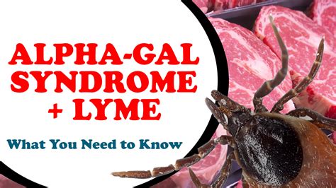 Alpha-gal Disorder and also Lyme: What You Required to Know - Health ...